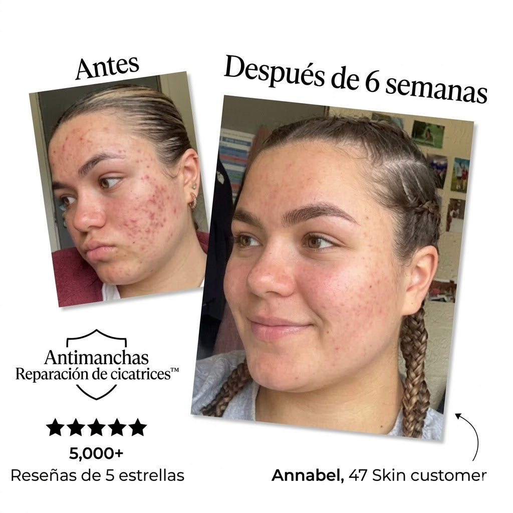 Sérum anti-imperfecciones y reparador de cicatrices