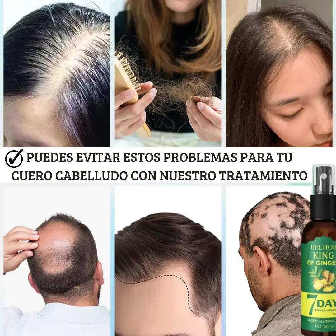 ¡La Fórmula Secreta para un Cabello Abundante y Fuerte!  + 🎁 Lleva  2x1