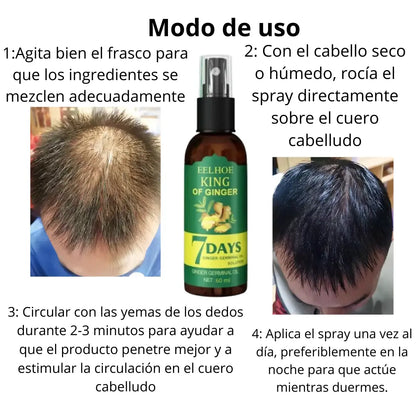 ¡La Fórmula Secreta para un Cabello Abundante y Fuerte!  + 🎁 Lleva  2x1