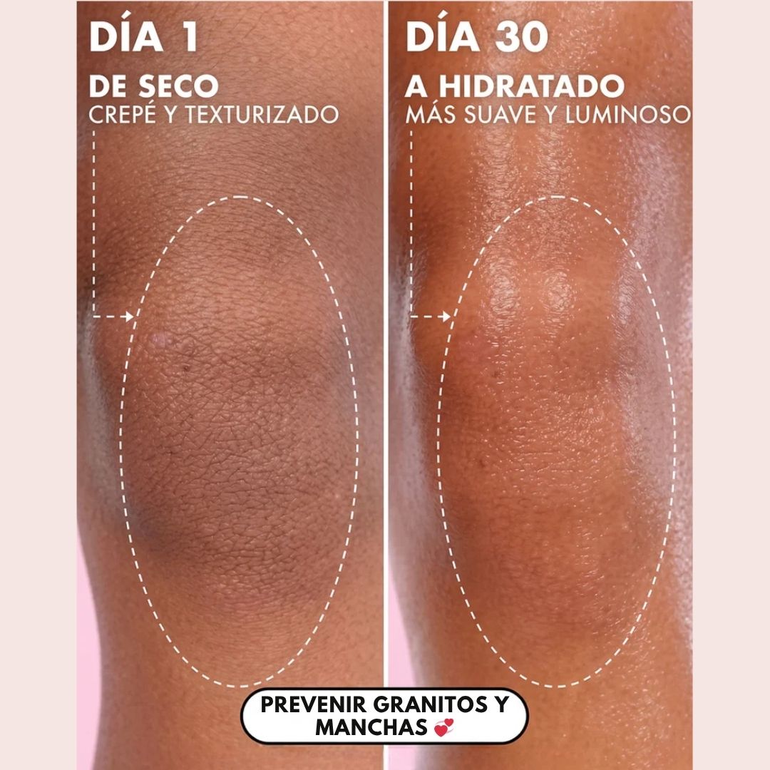 El kit íntimo que blanquea tu piel🌸