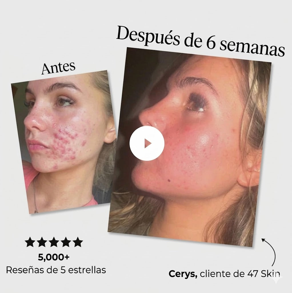 Sérum anti-imperfecciones y reparador de cicatrices