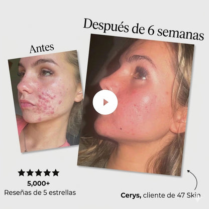 Sérum anti-imperfecciones y reparador de cicatrices